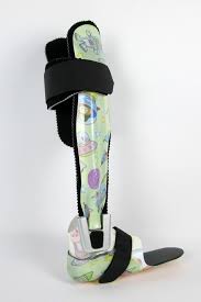 Eine Unterschenkelorthese Zur Monolateralen Versorgung Einer Cerebralparese Das Neuro Swing Gelenk Kann Je Nach Gangmuster Mit Ver Verschiedenes Kinder Muster