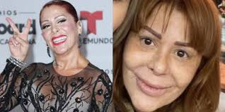 We did not find results for: Valio La Pena La Cirugia Plastica Preguntenle A Alejandra Guzman Liz Vega Lyn May Gaby Spanic 60 Minutos