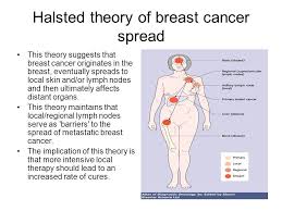 Pin On Lymph Nodes And Other Detected Ca
