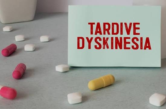 Tardive Dyskinesia: Symptoms, Cause, Treatment & Prevention | cult.fit