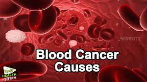 Blood cancer is also called leukemia. What Is Blood Cancer Blood Cancer Causes Cancer Treatment Youtube