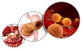 Image result for pancreas)