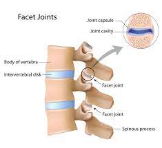 Symptoms Treatment Of Facet Joint Pain