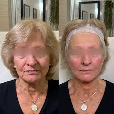 Profile for MMT aesthetics