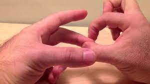 It is named after neurologist johann hoffmann. Hoffmann S Reflex Neurologyneeds Com