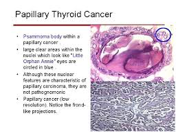 We did not find results for: Thyroid Pathology Last Updated Oct 5 2006 Jamie
