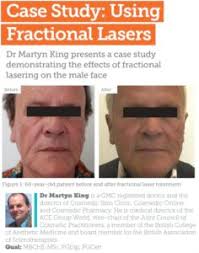 info, Author at Wingderm Electro-Optics Ltd.