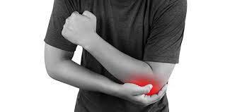 It's also important to point out that recovery from tennis elbow requires a proactive approach involving diagnosis, treatment and strengthening. Tips For Dealing With Tennis Elbow Iona Physiotherapy Physiotherapy In Dublin