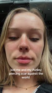 Ashley Scar
