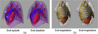 The sagittal mri images are hands down the easiest to look at and understand. Virtual Clinical Trials In Medical Imaging A Review