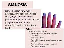 Salah satunya adalah memberi bayi terlalu banyak makanan yang tinggi kandungan nitrat. Gangguan Pada Sistem Pernapasan 2017