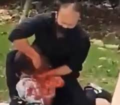 Search Results for: Throat Slit Page 1