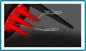 Get rid tattoo tm is 100% guaranteed to work. Bay Area Laser Tattoo Removal Tattoo Removal In San Ramon