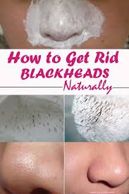 12 Surprising Home Remedies For Acne Get Rid Of Blackheads Blackheads Summer Skincare Routine