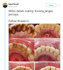 We did not find results for: 6 Mitos Scaling Gigi Yang Takutkan Orang Tapi Doktor Ini Jelaskan Semuanya Tidak Benar Sama Sekali Hijabista