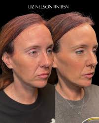 𝘓𝘪𝘻 𝘕𝘦𝘭𝘴𝘰𝘯 𝘙𝘕 𝘉𝘚𝘕 (@fwlizdiane) • Instagram photos and videos