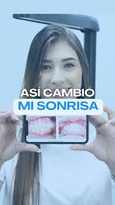 Le dimos un cambio a la sonrisa de Laura 🩵, Cuando Laura llegó a nosotros  no estaba a gusto como se veían sus dientes, por eso creía que debía  realizarse varios procedimientos para lograr tener su ...