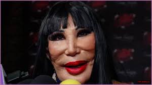 Lyn May Face Incident: A Comprehensive Overview