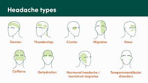 Image result for Headache