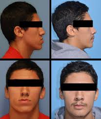 Parkland/UTSW Program update