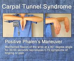 Image result for Carpal Compression Test
