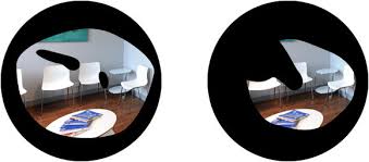 Gruner Star Glaukom Das Auge Schilgen