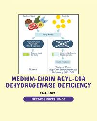 Image result for MCAD Deficiency