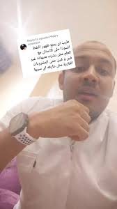 سبب سواد الاسنان