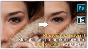 Tapi dari berbagai cara, yang menurut aku paling. Cara Menghilangkan Lingkaran Hitam Pada Mata Photoshop Tutorial Lingkaran
