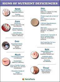 Nutraphoria Healthy Body Health Mind Healthy Spirit Nutritional Deficiencies Nutrient Deficiency Health And Nutrition