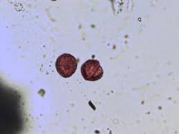 Image result for Eriocoelum