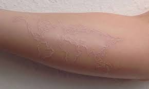 If the white ink tattoo becomes uncomfortable then you should follow the aftercare instructions given by the professionals. 101 Cute White Ink Tattoos Best Design Ideas 2021 Guide