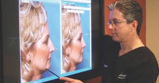 Simulate nose jobs (rhinoplasty), neck lifts, chin augmentation, botox, breast augmentation, and more. What Would I Look Like With A Nose Job How To Predict Your Rhinoplasty Results In Orlando Primera Plastic Surgery