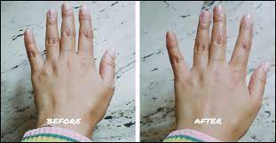 Oil palm industry is the largest contributor of biomass in malaysia. Bio Oil Review And Benefits How To Use Bio Oil For Stretch Marks
