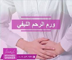 خليني اوضحلك يعني ايه نزيف أثناء ايام الدورة الشهرية أو زيادة في كمية الدم المفقود أثناء الدورة الشهرية الطبيعي أن الايام اللي بيستمر فيها نزيف الدورة الشهرية