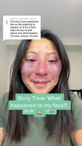 What Happened to Becca Lee Face