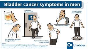 Bladder cancer signs and symptoms may include: Bladder Cancer Symptoms Cxbladder