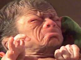 See more of the curious case of benjamin button on facebook. Real Life Benjamin Button Newborn Baby Looks Like An 80 Year Old You