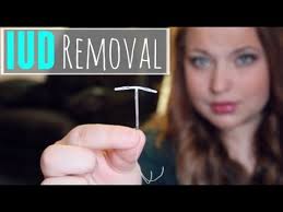 Ibuprofen (advil, motrin) to take 30 to 60 minutes beforehand to reduce pain and cramping. Iud Removal My Experience Youtube