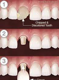 Pin On Dental Services Livonia Mi