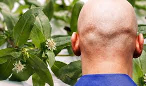 Use a dandruff shampoo at the first sign of dandruff and seek medical advice if symptoms do not improve within a week or two. Hair Loss Treatment The Herbal Oil Proven To Promote Hair Growth And Improve Dandruff Sound Health And Lasting Wealth