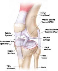 Calcified loose bodies removed from the knee joint of a patient with synovial chondromatosis. Knee Arthroscopy Vs Total Knee Replacement Three Rivers Orthopedics