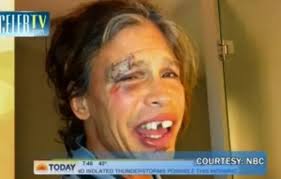 Steven Tyler Explains Shower Fall On Today Show