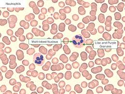 Image result for Peripheral Smear