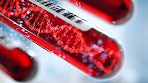 High or low levels of certain substances in your body can be a sign of cancer. Plasmamatch Trial Matches Female Breast Cancer Patients To Precision Treatments Using Blood Test Technology Networks