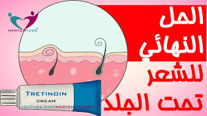 كيفية إزالة الشعر تحت الجلد Youtube