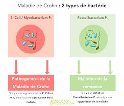 Check spelling or type a new query. Comment Se Sortir De La Maladie De Crohn Bmoove
