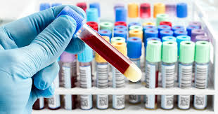 How are tumor marker tests done? A Simple Blood Test May Help Illustrate A Patient S Cancer Ctca