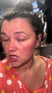 Exploring Nature with My Skeeter