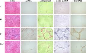 The site also hosts data mining and analysis tools for rat genomics and physiology. References In Halofuginone An Inhibitor Of Collagen Synthesis By Rat Stellate Cells Stimulates Insulin Like Growth Factor Binding Protein 1 Synthesis By Hepatocytes Journal Of Hepatology